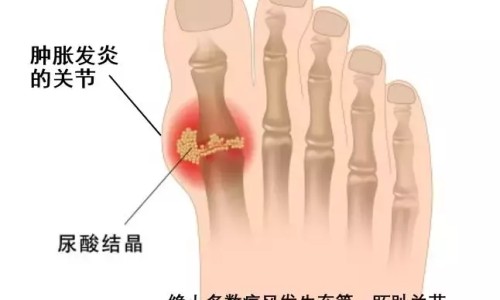 禁食病人补液配网 - 网站提供禁食病人补液配比小常识、禁食病人补液量至少多少ml